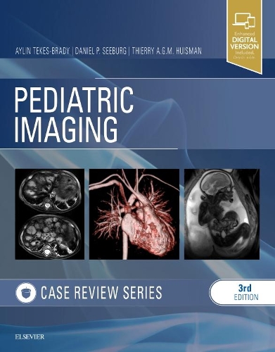 [object Object] «Pediatric Imaging: Case Review Series», авторов Айлин Текес-Бради, Дэниел П. Сибург, Тьерри А. Г. М. Хуисман - фото №1