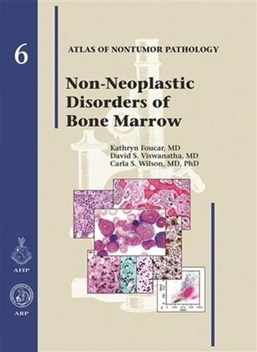 [object Object] «Non-Neoplastic Diseases of Bone Marrow», авторов Эми Ноффсингер, Карла С. Уилсон, Дэвид С. Вишванатха - фото №1