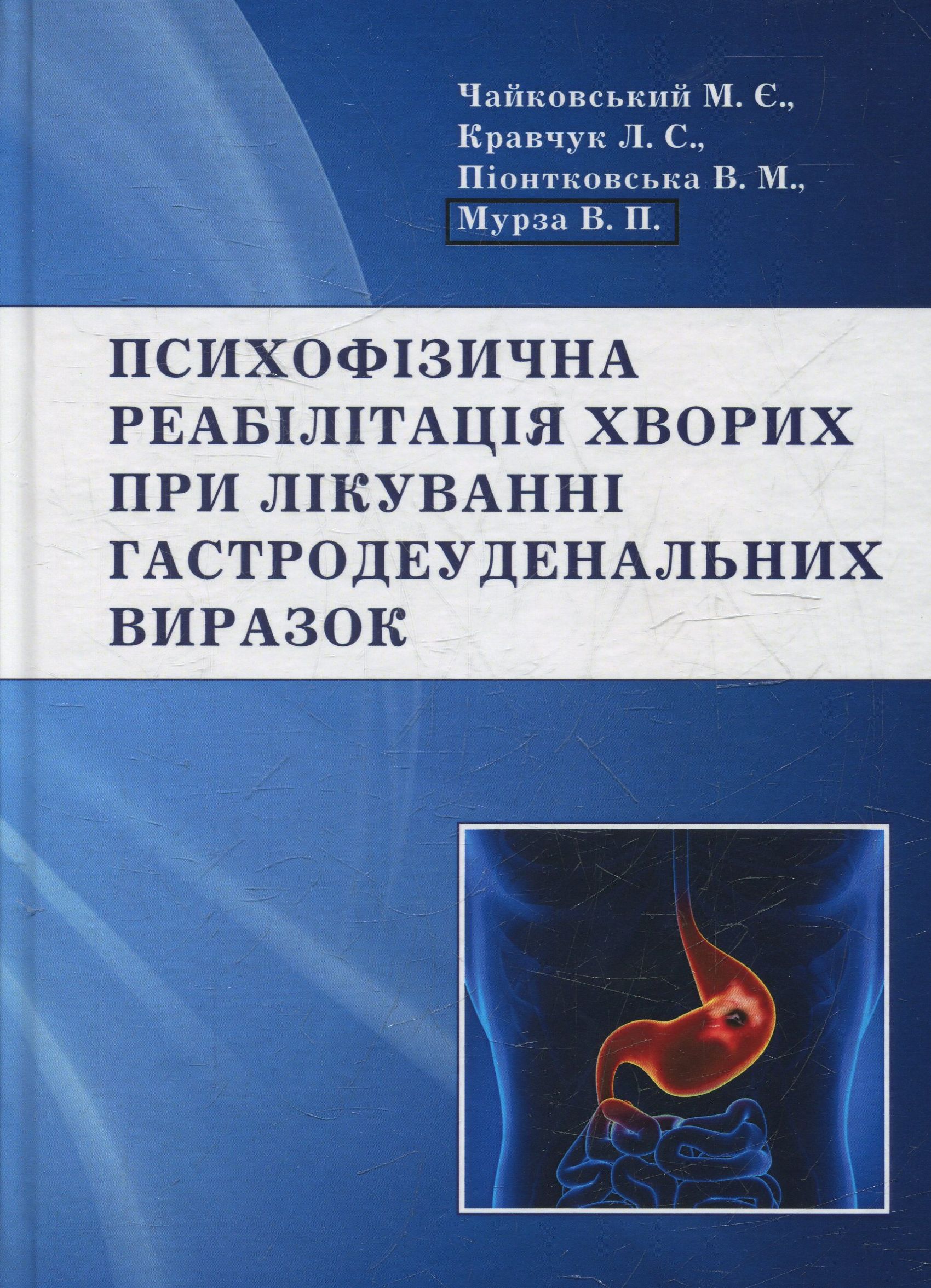 

Психофізична реабілітація хворих при лікуванні гастродеуденальних виразок