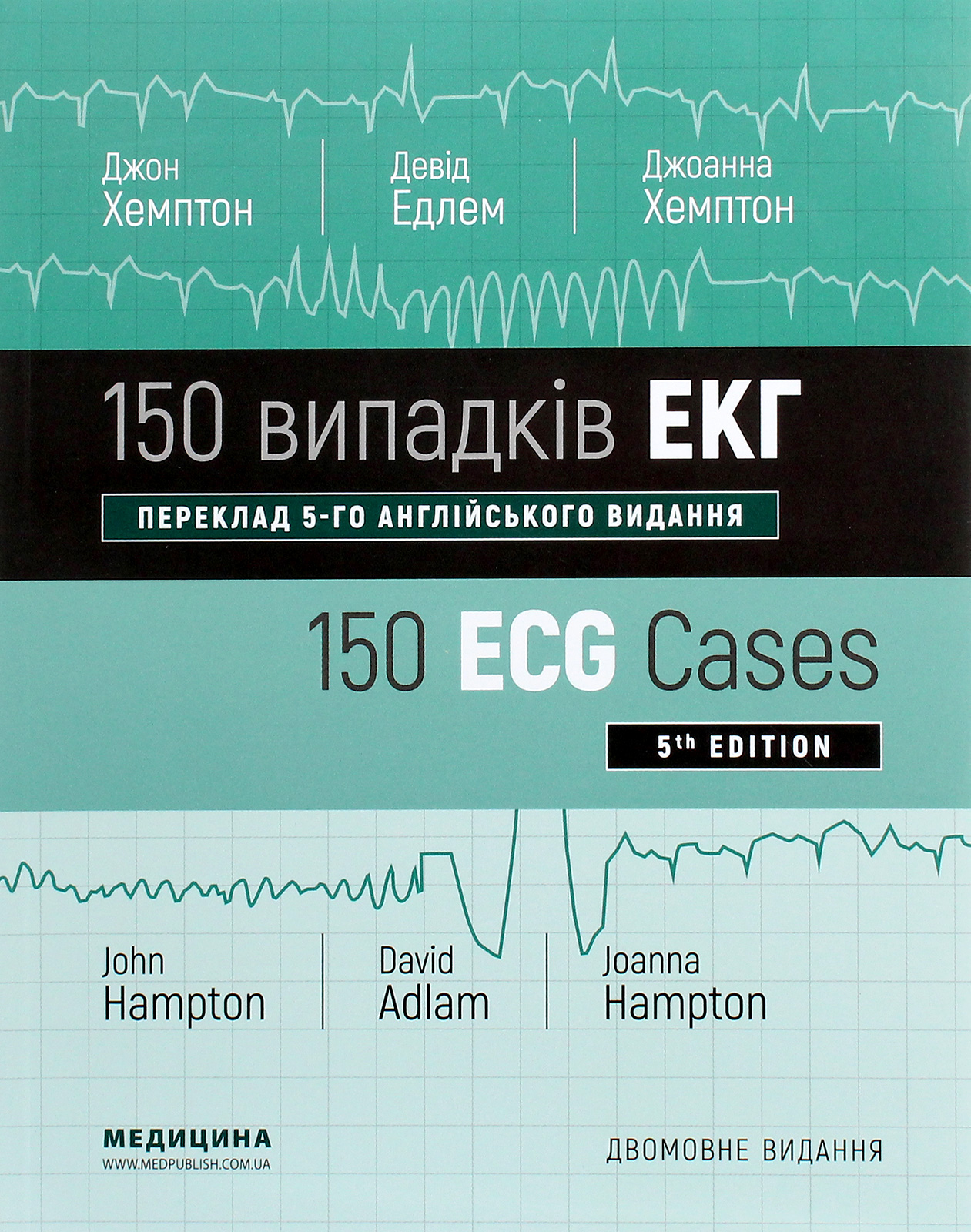 

150 випадків ЕКГ / 150 ECG Cases