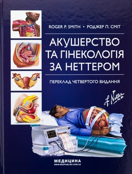 Бумажная книга «Акушерство та гінекологія за Неттером», автор Роджер П. Смит - фото №1 - миниатюра