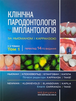 Паперова книга «Клінічна пародонтологія та імплантологія за Ньюманом і Карранзою. В 2-х томах», авторів Майкл Г. Ньюман, Перрі Р. Клоккеволд, Сатіш Елангован, Івонн Л. Ернандес-Капіла - фото №1 - мініатюра