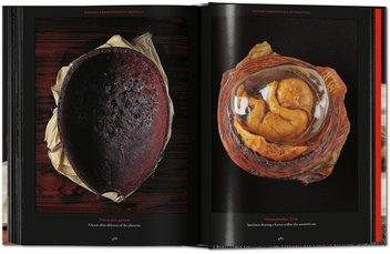 Бумажная книга «Anatomical Waxes», автор Марта Поггеси - фото №13 - миниатюра