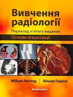 Бумажная книга «Вивчення радіології. Основи візуалізації», автор Уильям Херринг - фото №1 - миниатюра