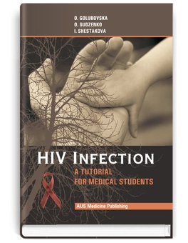 Паперова книга «HIV-infection», авторів О.А. Голубовська, А.А. Гудзенко, І.В. Шестакова - фото №2 - мініатюра