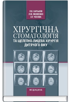 Бумажная книга «Хірургічна стоматологія та щелепно-лицева хірургія дитячого віку», авторов Леонид Харьков, Людмила Яковенко, Ирина Чехова - фото №2 - миниатюра