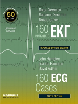 Бумажная книга «160 випадків ЕКГ. 160 ECG Cases», авторов Джон Хэмптон, Дэвид Адлам, Джоанна Хэмптон - фото №1 - миниатюра