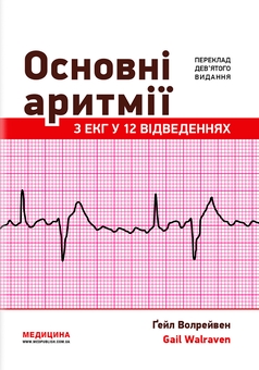 Паперова книга «Основні аритмії з ЕКГ у 12 відведеннях», автор Ґейл Волрейвен - фото №1 - мініатюра