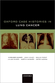 Паперова книга «Oxford Case Histories in Lung Cancer», авторів Адам Ейнлі, Антке Гаґена, Хімендер К. Маккер, Джуліан Сінґер, Мартін Гейворд, Санджай Попат - фото №1 - мініатюра