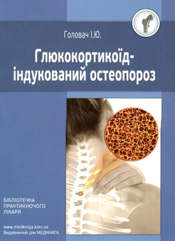 Паперова книга «Глюкокортикоїд-індукований остеопороз», автор Ірина Головач - фото №1 - мініатюра