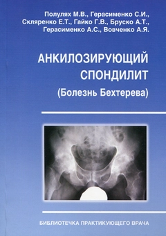 Бумажная «Анкилозирующий спондилит. Болезнь Бехтерева», автора Михаил Популях– фото №1