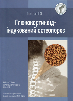 Бумажная книга «Глюкокортикоїд-індукований остеопороз», автор И. Головач - фото №1 - миниатюра