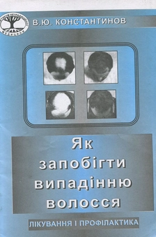 Бумажная книга «Як запобігти випадінню волосся. Методика лікування гніздового облисіння (алопеції)», автор Владимир Константинов - фото №1 - миниатюра