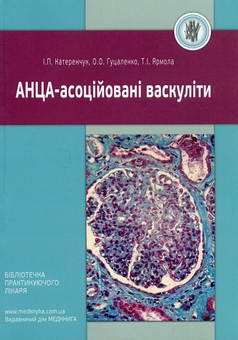 Паперова книга «АНЦА-асоційовані васкуліти», авторів Іван Катеренчук, О.О. Гуцаленко, Тетяна Ярмола - фото №1 - мініатюра