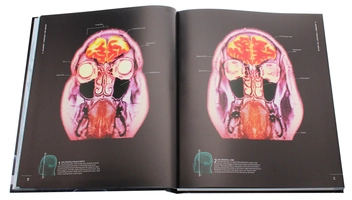 Паперова книга «The Brain Book. An Illustrated Guide to its Structure, Functions, and Disorders », авторів Стів Паркер, Ріта Картер, Сьюзан Олдрідж, Мартін Пейдж - фото №13 - мініатюра