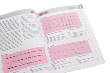 Бумажная книга «Основи ЕКГ / The ECG Made Easy», авторов Джон Хэмптон, Джоанна Хэмптон - фото №5 - миниатюра