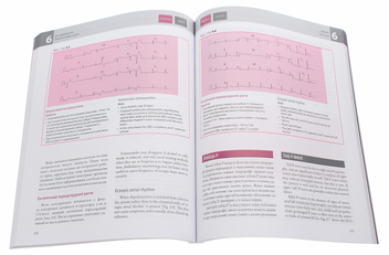 Бумажная книга «Основи ЕКГ / The ECG Made Easy», авторов Джон Хэмптон, Джоанна Хэмптон - фото №6 - миниатюра