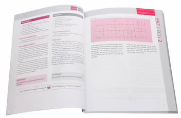 Бумажная книга «150 випадків ЕКГ / 150 ECG Cases», авторов Джон Хэмптон, Джоанна Хэмптон - фото №4 - миниатюра