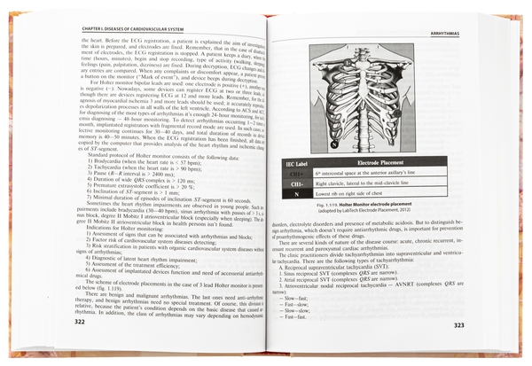 [object Object] «Internal Medicine: in 2 books. Book 1. Diseases of the Cardiovascular and Respiratory Systems», авторів Нестор Середюк, Ігор Вакалюк, Роман Яцишин - фото №5 - мініатюра