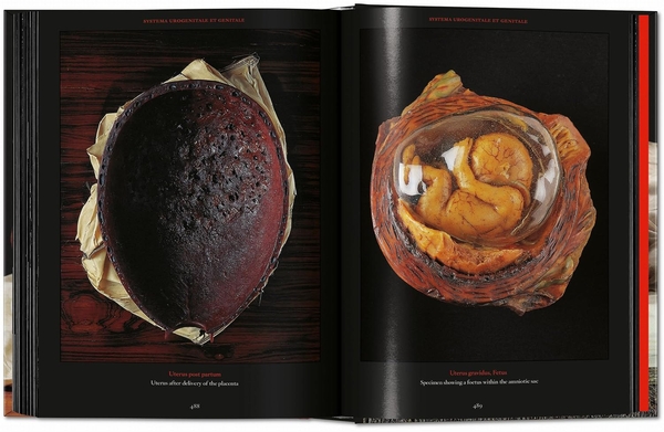 Бумажная книга «Anatomical Waxes», автор Марта Поггеси - фото №1