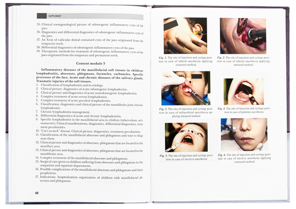 Паперова книга «Pediatric Oral and Maxillofacial Surgery», авторів Леонід Харьков, Н. Кісельова, Людмила Яковенко - фото №1