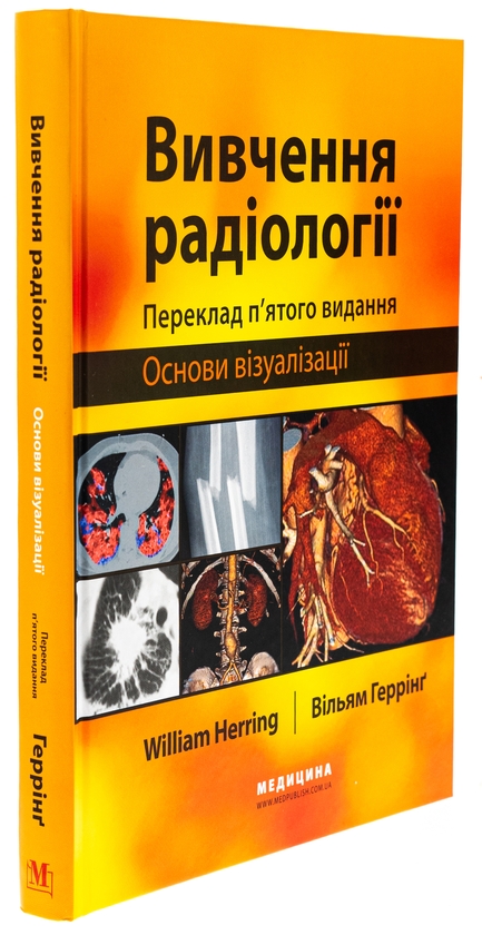 Бумажная книга «Вивчення радіології. Основи візуалізації», автор Уильям Херринг - фото №1