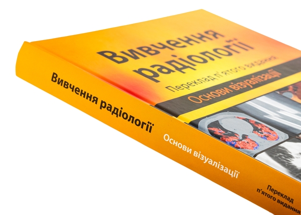 Бумажная книга «Вивчення радіології. Основи візуалізації», автор Уильям Херринг - фото №1