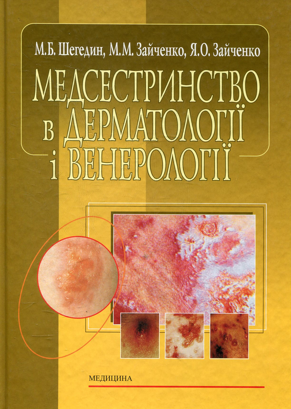 Бумажная книга «Медсестринство в дерматології і венерології», автор Мария Шегедин - фото №1
