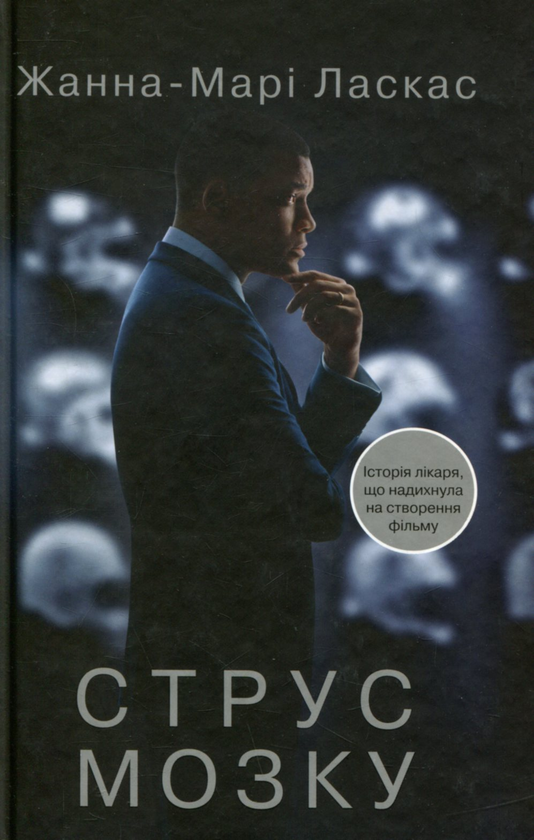 Паперова книга «Струс мозку», автор Жанна Марі Ласкас - фото №1