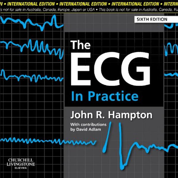 Паперова книга «The ECG in Practice» - фото №1