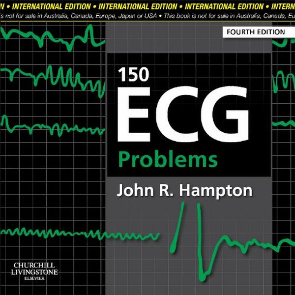 Паперова книга «150 ECG Problems» - фото №1