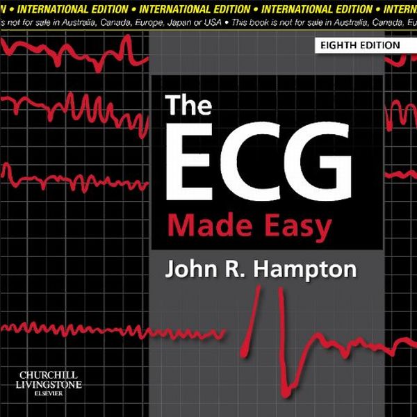Паперова книга «The ECG Made Easy» - фото №1