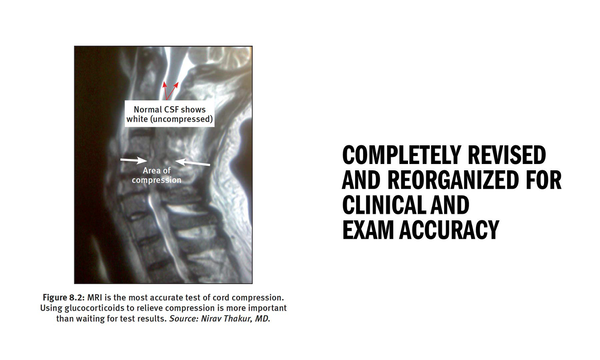 Бумажная книга «Master the Boards USMLE Step 2 CK», автор Конрад Фишер - фото №1