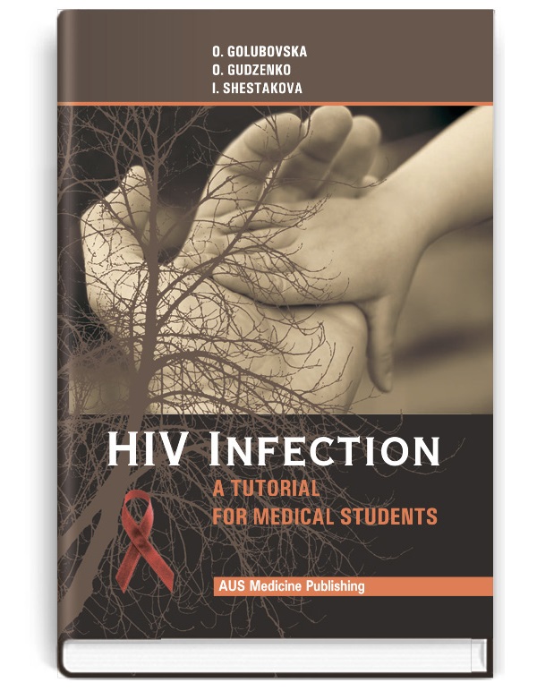 Паперова книга «HIV-infection», авторів О.А. Голубовська, А.А. Гудзенко, І.В. Шестакова - фото №1