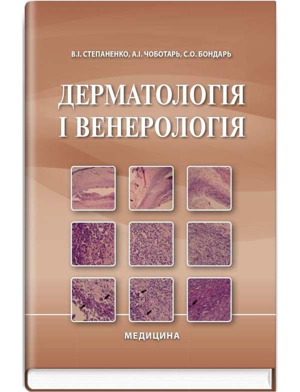 Паперова книга «Дерматологія і венерологія», авторів Виктор Степаненко, Світлана Бондарь, Анатолій Чоботарь - фото №1