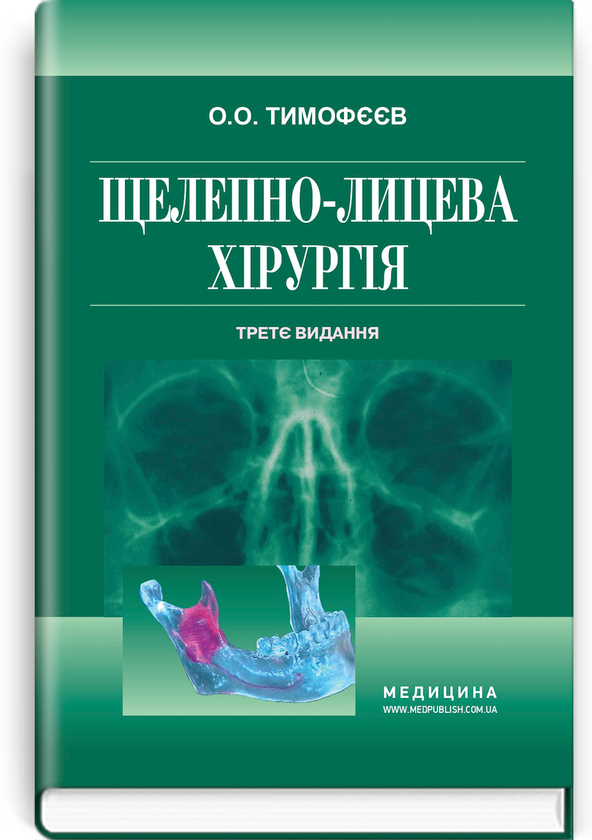 [object Object] «Щелепно-лицева хірургія», автор Алексей Тимофеев - фото №1