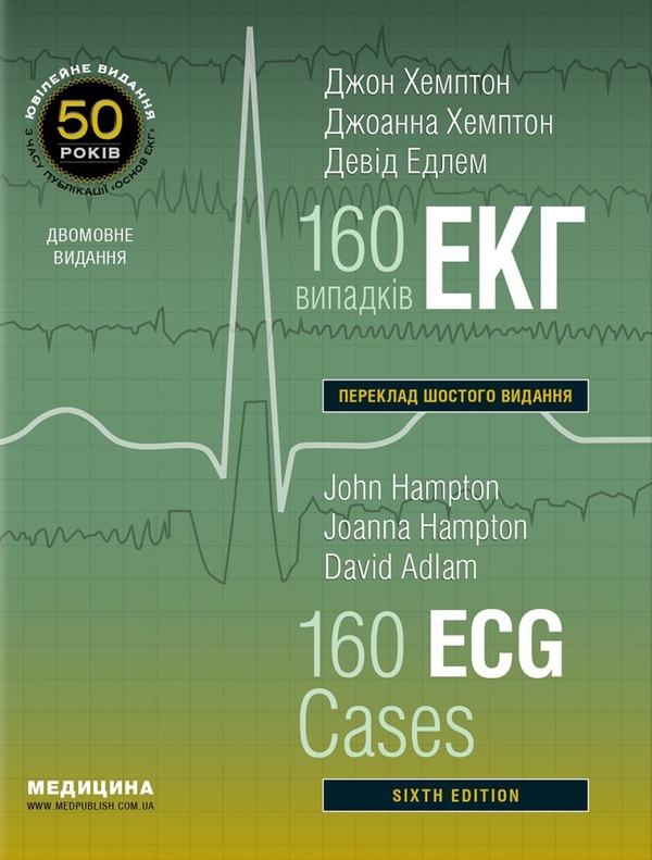 Книга 160 випадків ЕКГ. 160 ECG Cases