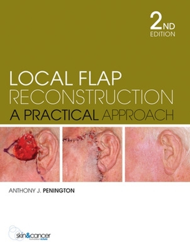 Бумажная книга «Local Flap Reconstruction», автор Энтони Пенингтон - фото №1