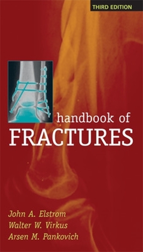Паперова книга «Handbook of Fractures, Third Edition», автор Волтер Віркус - фото №1