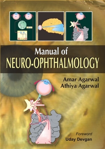 [object Object] «Manual of Neuro-Ophthalmology», авторів Амар Агарвал, Атхія Агарвал - фото №1
