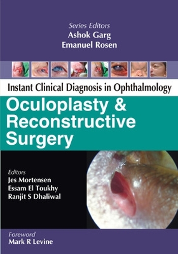 Бумажная книга «Oculoplasty and Reconstructive Surgery», авторов Эссам Эль-Тухки, Джес Мортенсен - фото №1