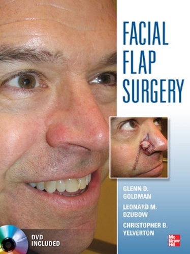 Паперова книга «Facial Flaps Surgery», автор Гленн Голдман - фото №1