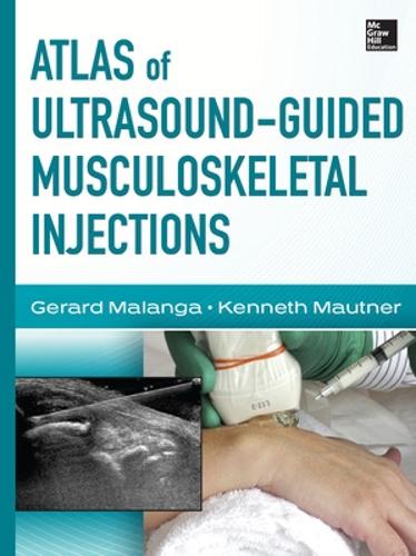 Бумажная книга «Atlas of Ultrasound-Guided Musculoskeletal Injections», авторов Жерар Маланга, Кеннет Маутнер - фото №1