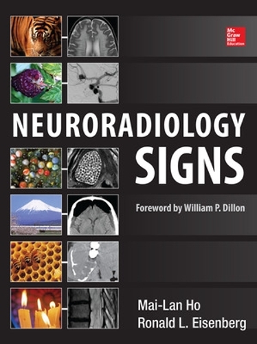 Бумажная книга «Neuroradiology Signs», автор Май-Лань Хо - фото №1