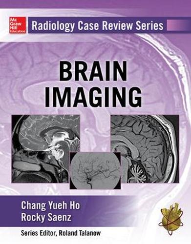 Бумажная книга «Radiology Case Review Series: Brain Imaging», авторов Чанг Хо, Роки Саенс - фото №1