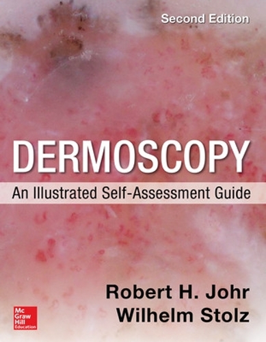 Бумажная книга «Dermoscopy: An Illustrated Self-Assessment Guide, 2/e», авторов Роберт Йор, Вильгельм Штольц - фото №1