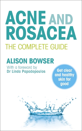 Паперова книга «Acne and Rosacea : The Complete Guide», автор Елісон Баузер - фото №1