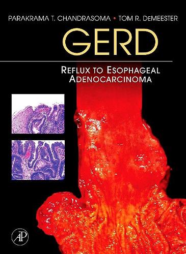 Бумажная книга «GERD: Reflux to Esophageal Adenocarcinoma», авторов Паракрама Т. Чандрасома, Том Р. ДеМистер - фото №1