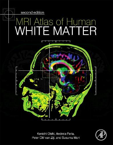 Бумажная книга «MRI Atlas of Human White Matter», авторов Андрей В. Фариа, Кеничи Оиши, Питер К. М. ван Зейл, Сусуму Мори - фото №1