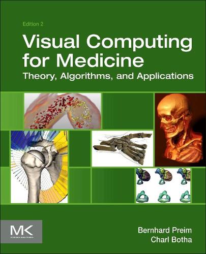 [object Object] «Visual Computing for Medicine: Theory, Algorithms, and Applications», авторів Бернхард Прейм, Чарльз П. Бота - фото №1